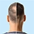 Male Pattern Baldness Treatment icon