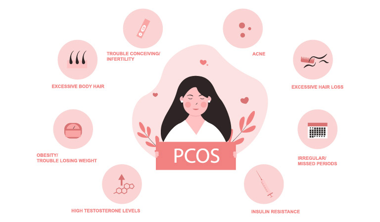 PCOS Causes