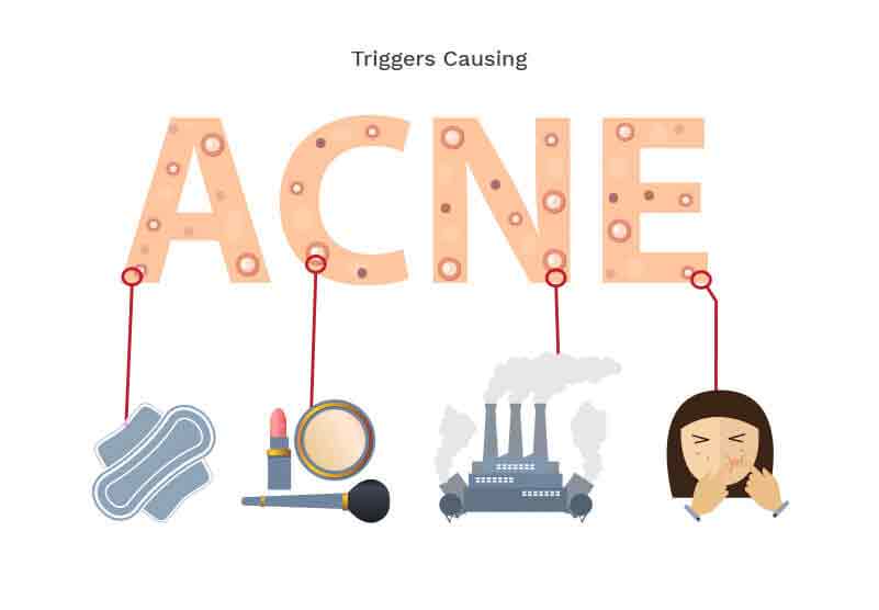 acne-causes