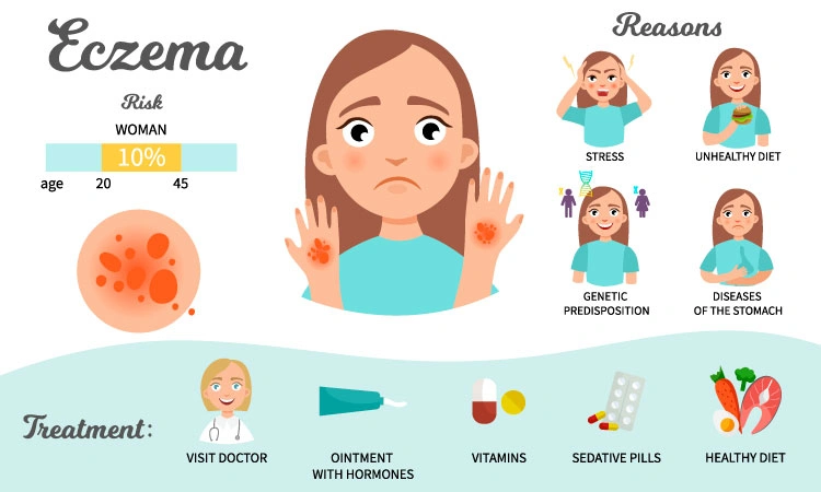 Tackle eczema this monsoon with homeopathy