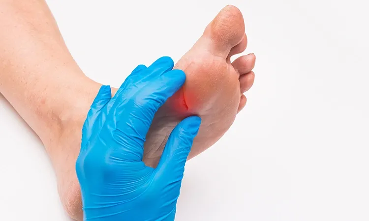 Prevention of Diabetic Foot Ulcer