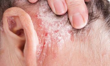 Know the 10 complications of psoriasis