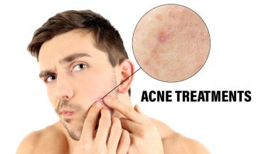 How to deal with sudden acne breakout on face? - Dr Batra's™