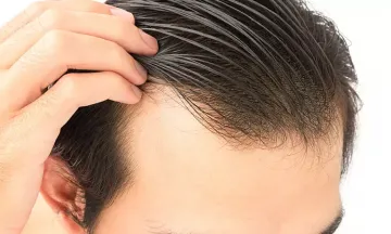 Hair Fall treatment