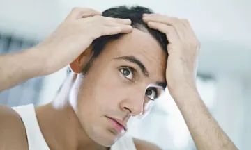 Are you scared of losing hair in future? Know it today with a genetic test