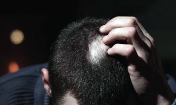 Can your hair grow back if you have alopecia areata?