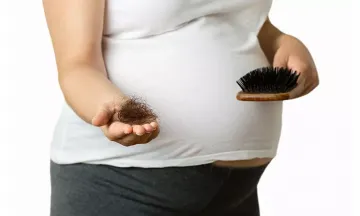 Pregnancy & hair fall in women