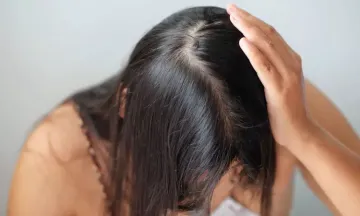 10 bad habits causing hair thinning