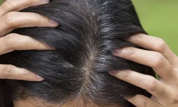 All you wanted to know about Grey hair