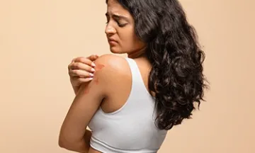 Causes of Eczema