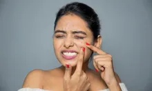 The most common mistake is aggravating your acne
