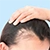 Female Pattern Baldness Causes icon