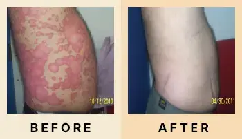 01 Before After