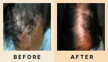 02 Before After