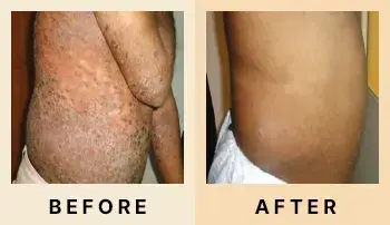 03 Before After