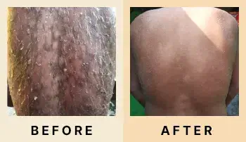 04 Before After