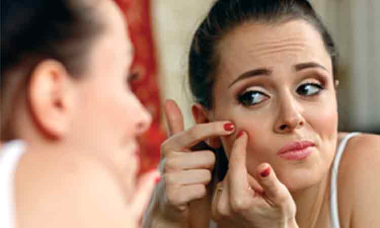 Healing with homeopathy – Acne caused due to PCOS Healing with homeopathy – Acne caused due to PCOS