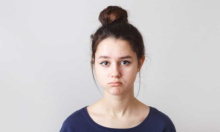 Teenage acne: when it’s time to see a doctor? Teenage acne: when it’s time to see a doctor?