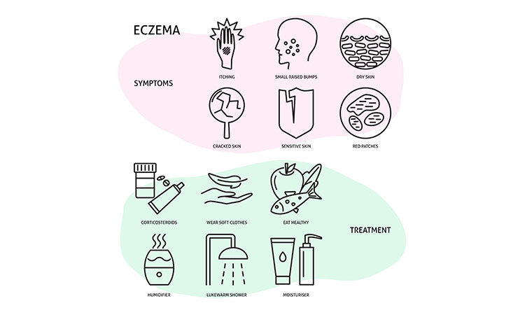 Is eczema merely a 'khujli'? Is eczema merely a 'khujli'?