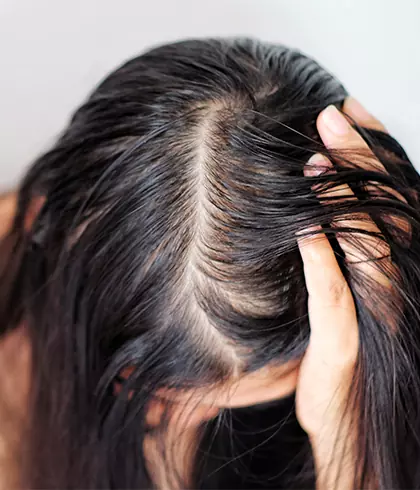Hairstyles for female pattern hair loss