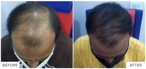 Prashant Singh cured case
