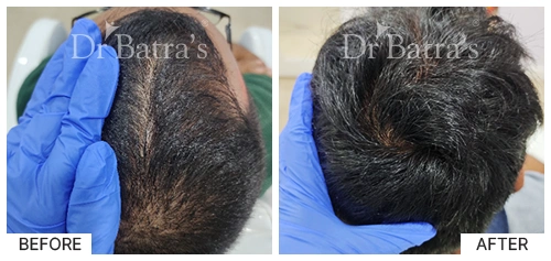 M Nitya Cured Hair 1