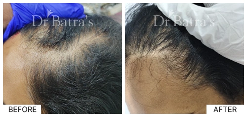 M Nitya Cured Hair 2