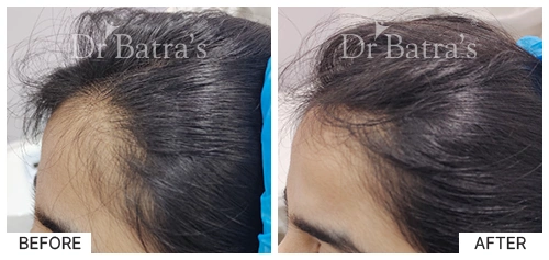 M Nitya Cured Hair 3
