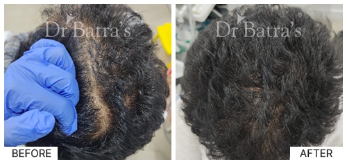M Nitya Cured Hair 4