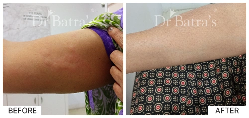 M Nitya Cured Skin 2