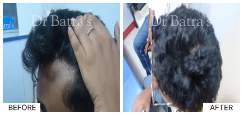 Marian Cured Hair 1
