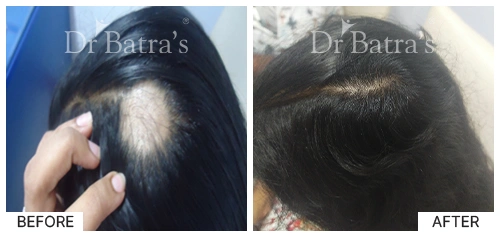 Marian Cured Hair 2