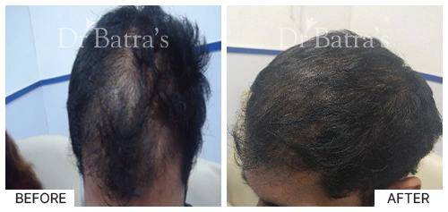 Marian Cured Hair 3