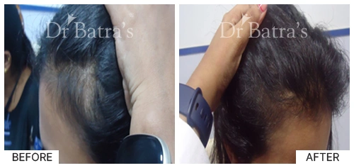 Marian Cured Hair 4