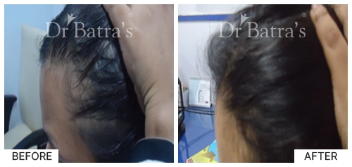 Marian Cured Hair 5