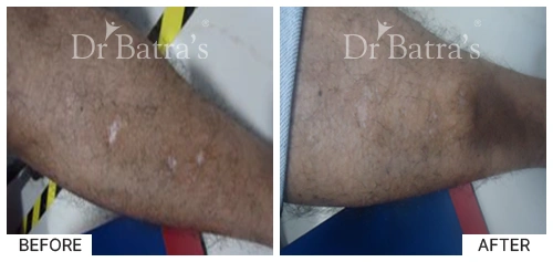 Marian Cured Skin 2