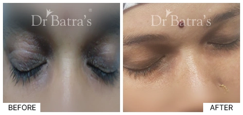 Marian Cured Skin 3