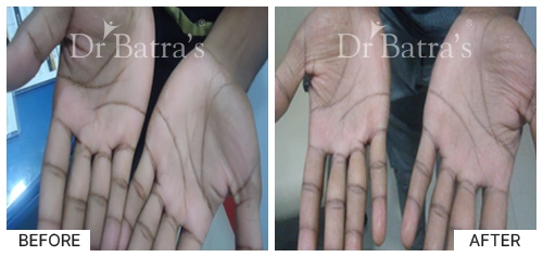 Marian Cured Skin 4