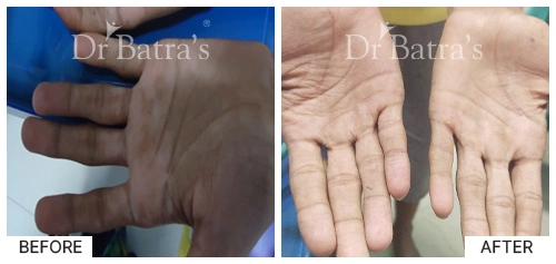 Marian Cured Skin 5