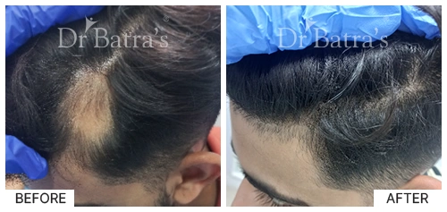 Nooreen Cured Hair 2