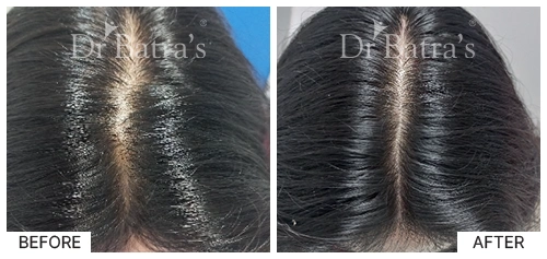 Nooreen Cured Hair 3