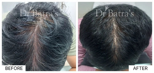 Nooreen Cured Hair 4