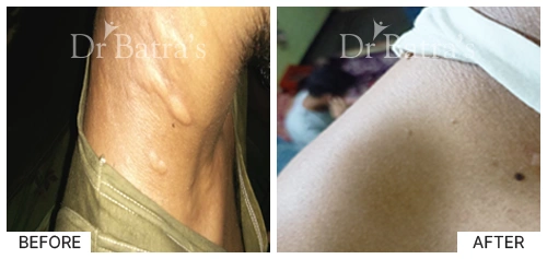 Nooreen Cured Skin 3