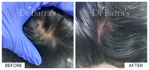 Nooreen Cured Skin 4