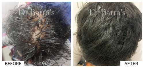 SheetalS Cured Hair 1
