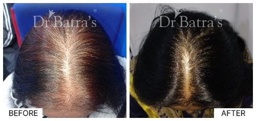 SheetalS Cured Hair 2