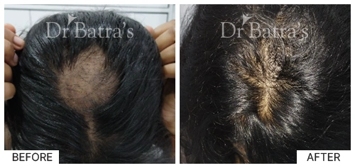 SheetalS Cured Hair 3