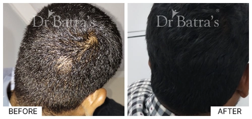 SheetalS Cured Hair 4