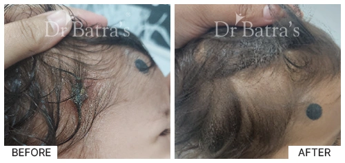 SheetalS Cured Skin 4