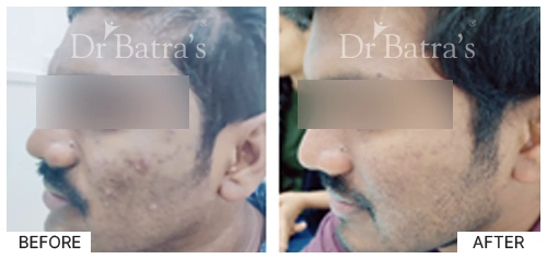 Dr Johncy cured case 1